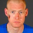 Ken Fox, an L.A. man, sued Redmond O’Neal, the son of Ryan O’Neal and the late Farrah Fawcett, for assault and battery, intentional infliction of emotional distress, violation of civil rights, […]