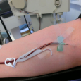 A plasma center turned away a transgender donor when she started identifying as a woman on their forms, possibly because of the FDA’s ban on gay men donating blood. Alice […]