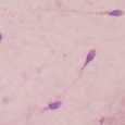 Last month, we told you how researchers at the University of Utah said it’s unlikely that COVID-19 can be transmitted through semen. Now, a separate study has cast doubt on […]