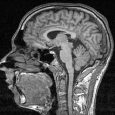 A controversial study on transgender people’s neurology at the University of California, Los Angeles (UCLA) has been suspended due to ethical concerns that the participants could face harm from the […]